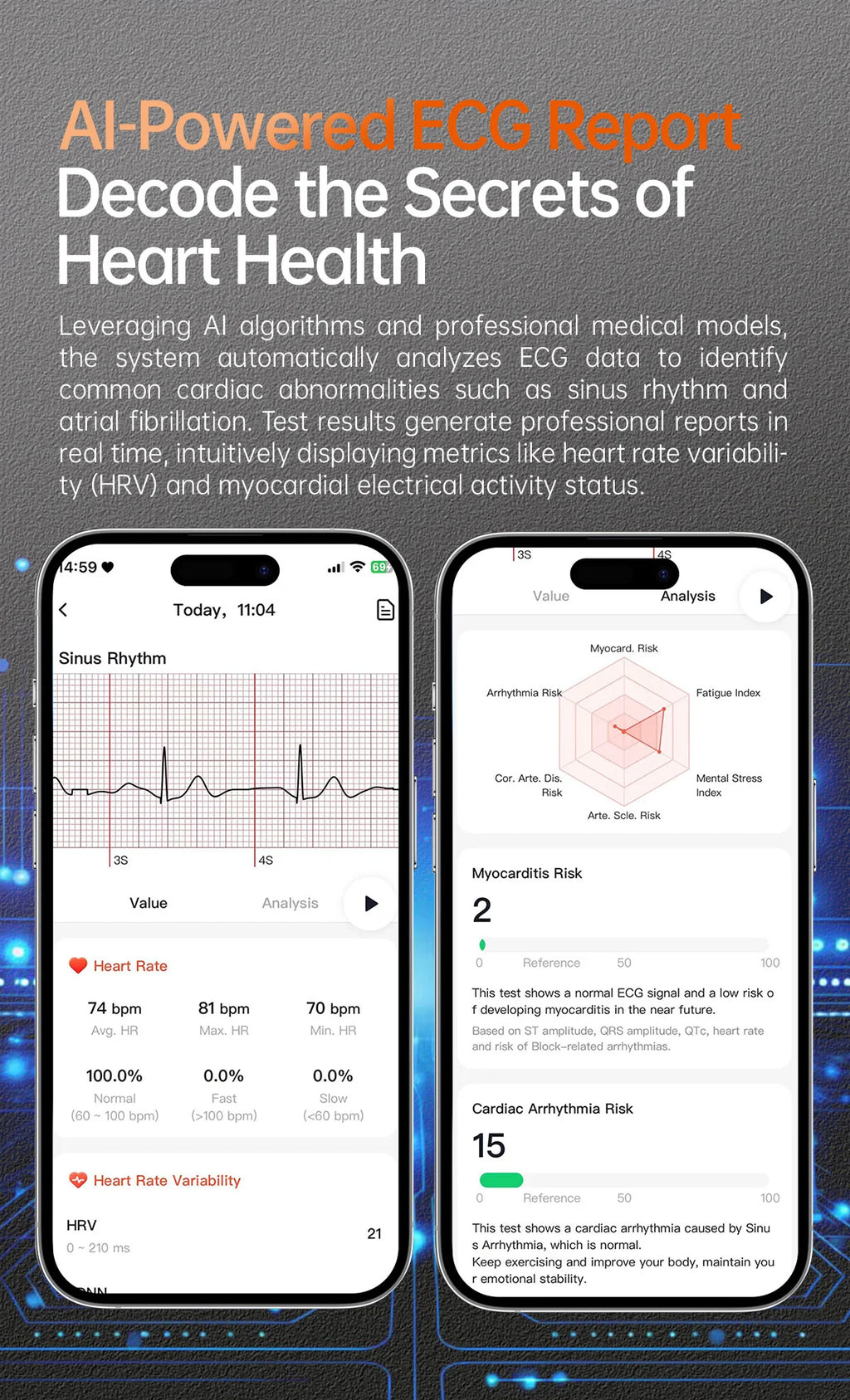 Dido AI E70S Reloj Inteligente ECG Ultrafino