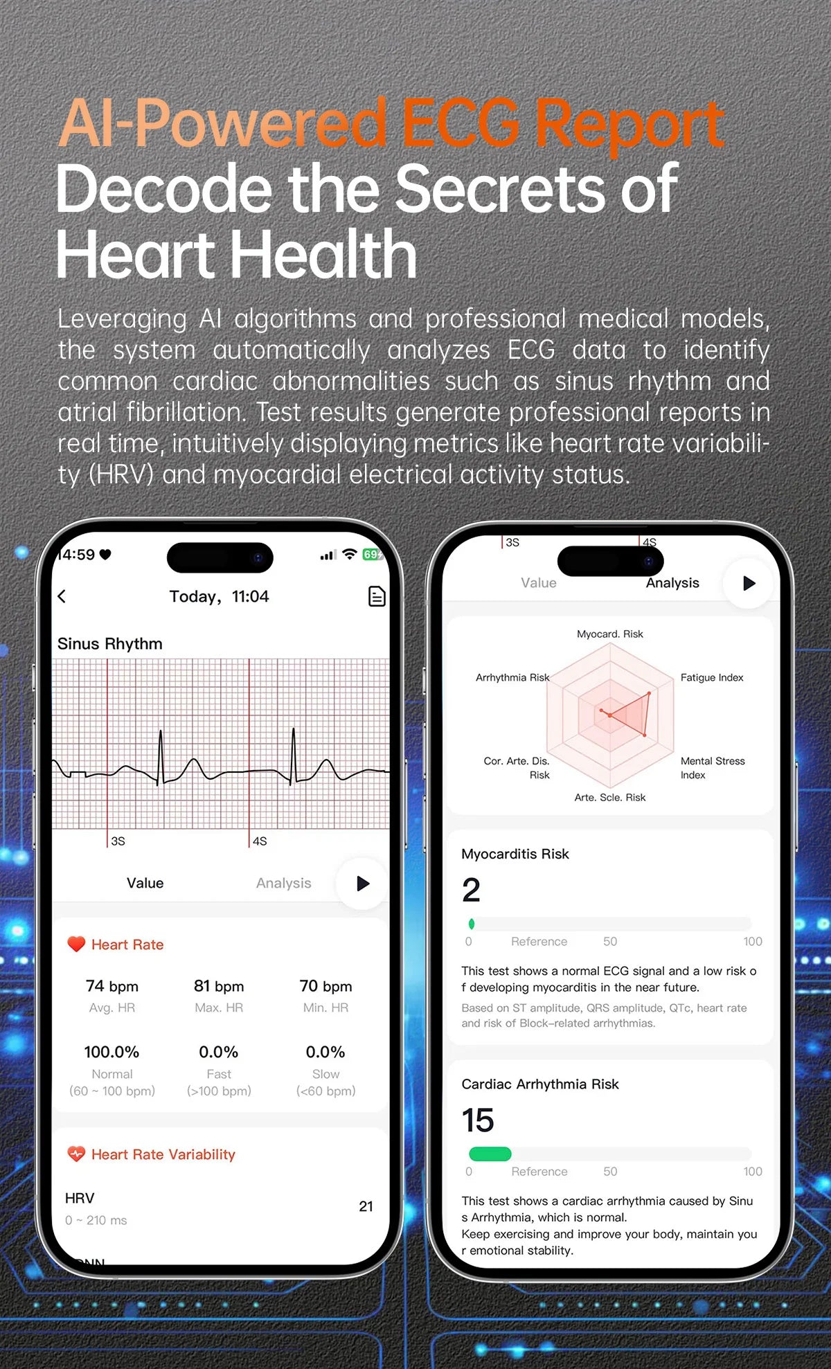 Dido AI E70S Reloj Inteligente ECG Ultrafino