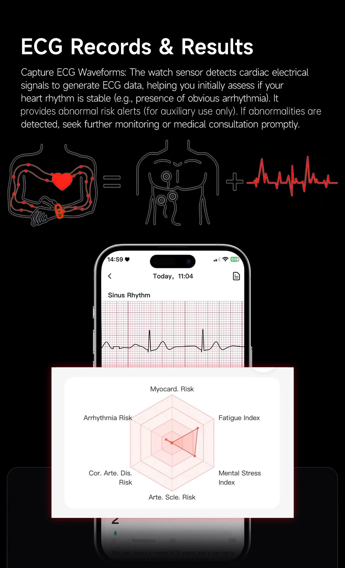 LIGE Pulsera Inteligente ECG+PPG Grado Médico