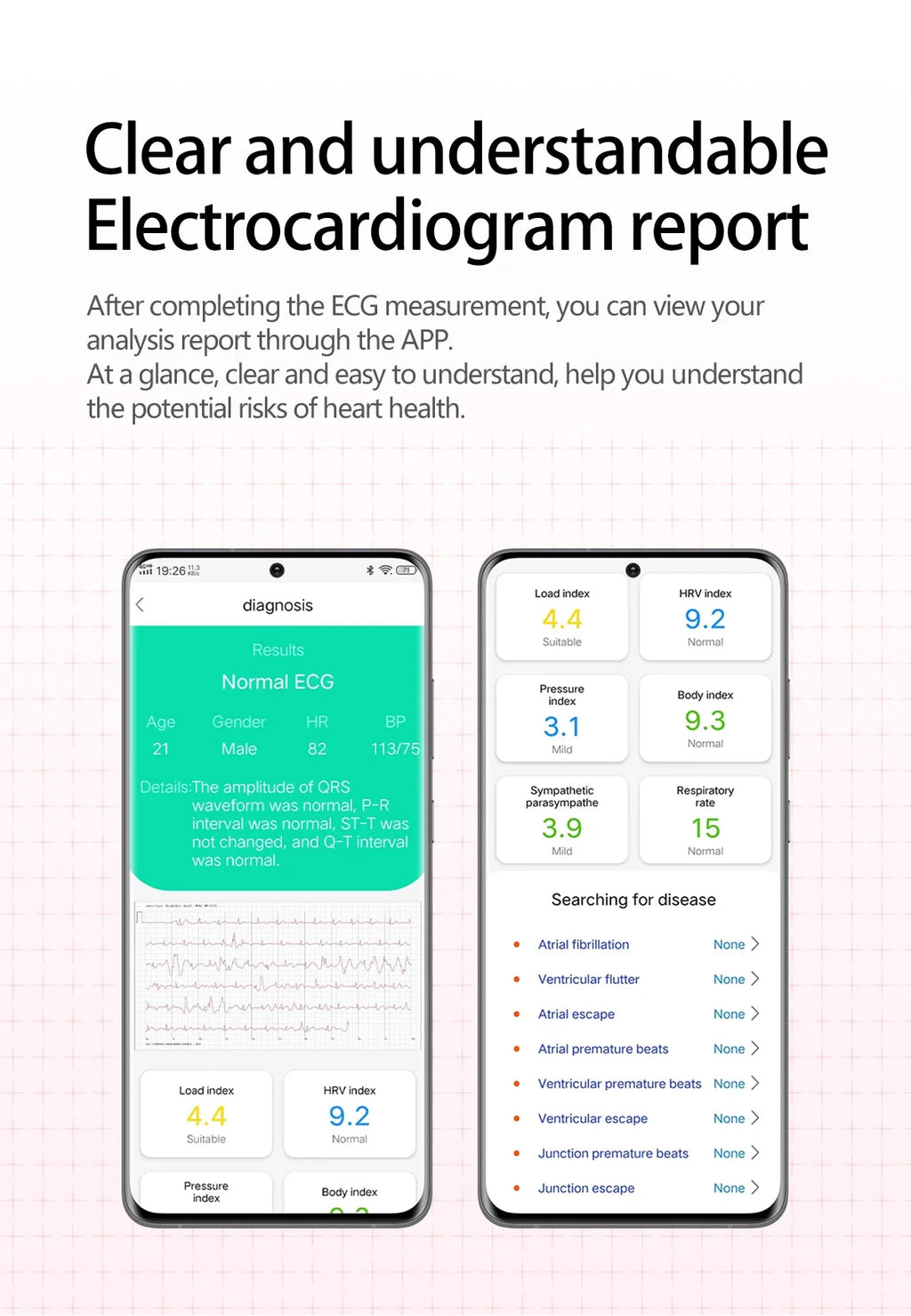 Reloj Inteligente ECG+PPG Enfermería NFC