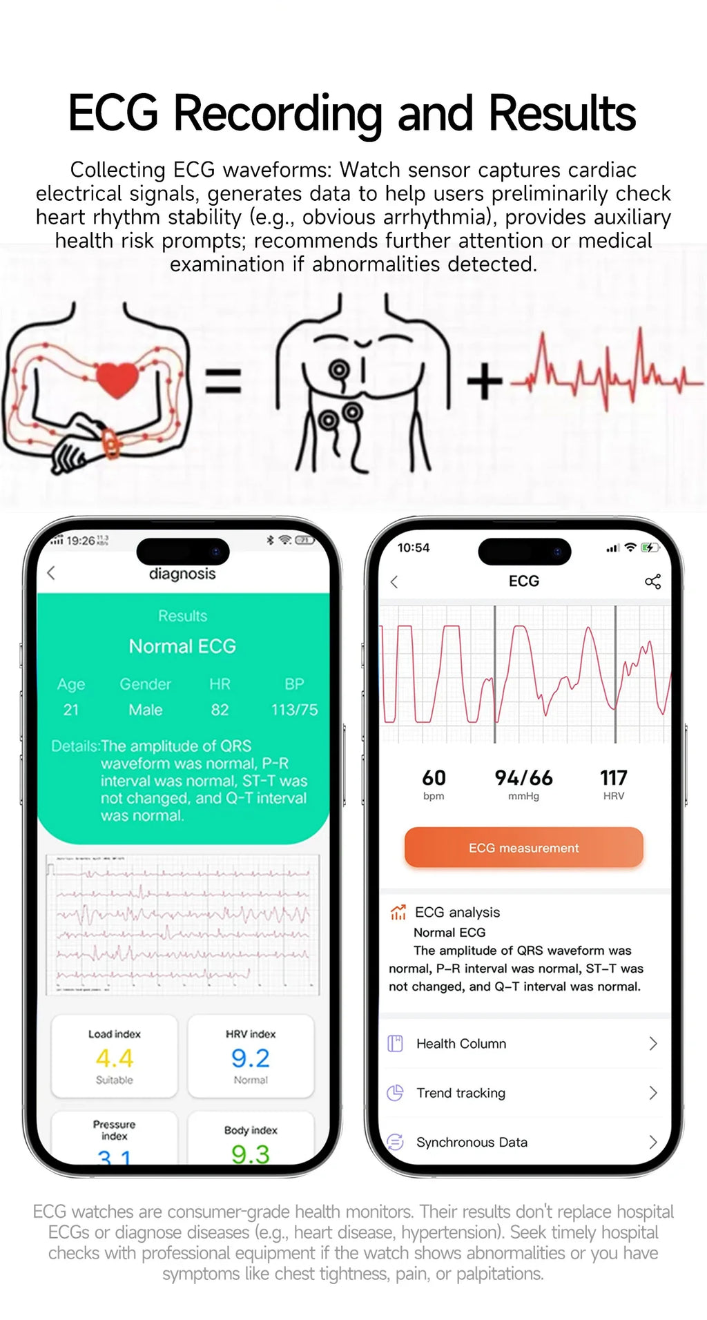 Reloj Inteligente Terapia Láser ECG Salud