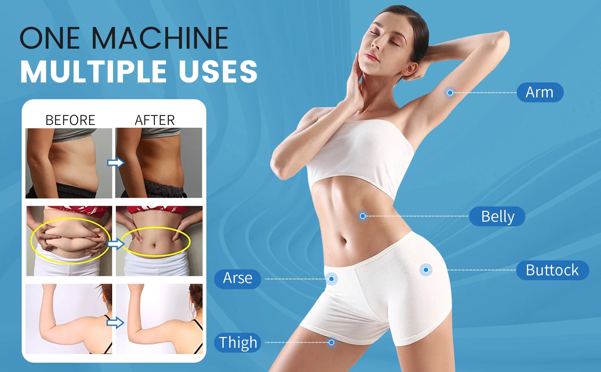 Máquina EMS para Esculpir el Cuerpo, Estimulación Muscular por Radiofrecuencia, Quema de Grasa, 6500W, Equipo de Adelgazamiento y Pérdida de Peso, Zero MYOslim EMS