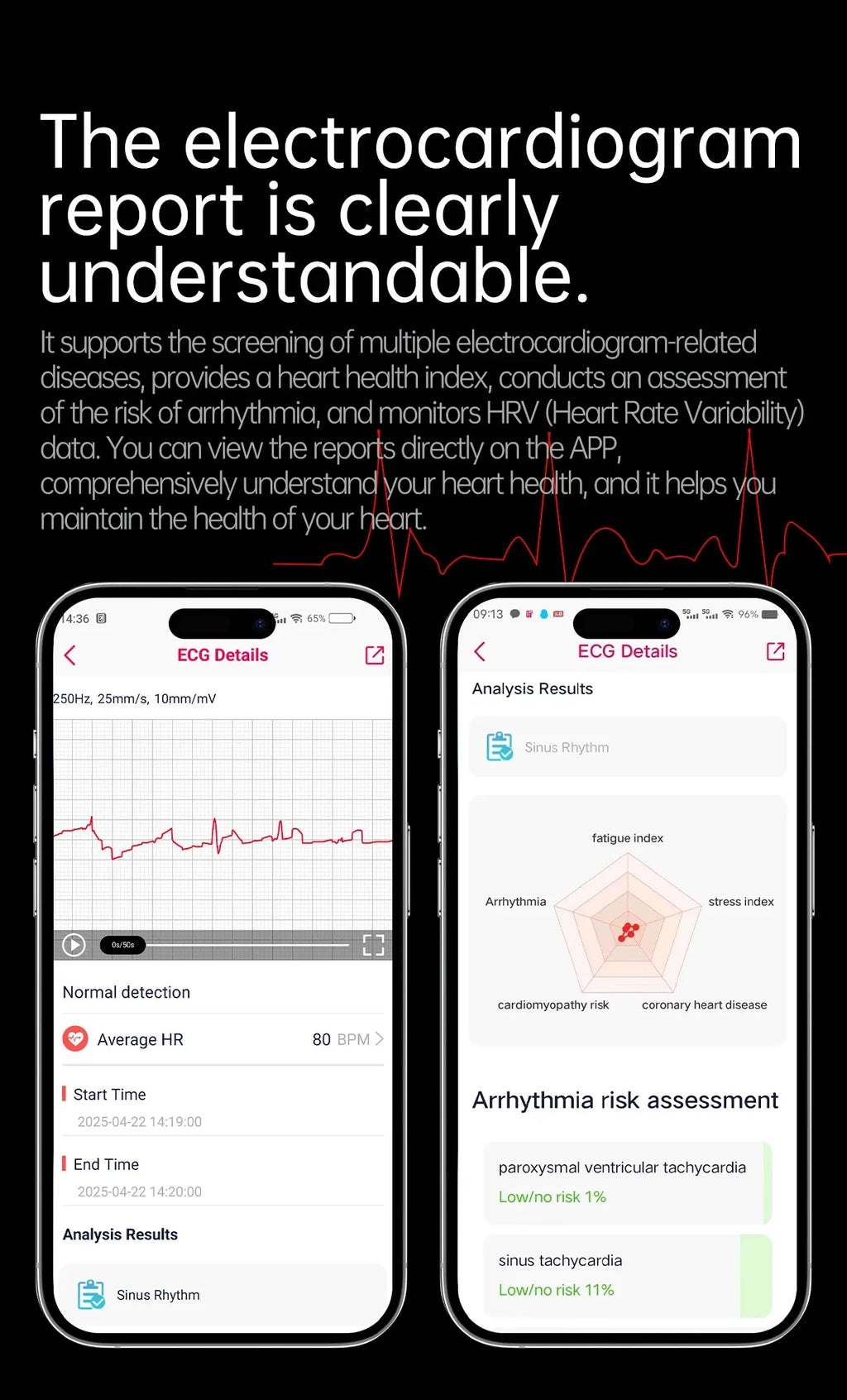 Reloj Inteligente Enfermería ECG+PPG Presión