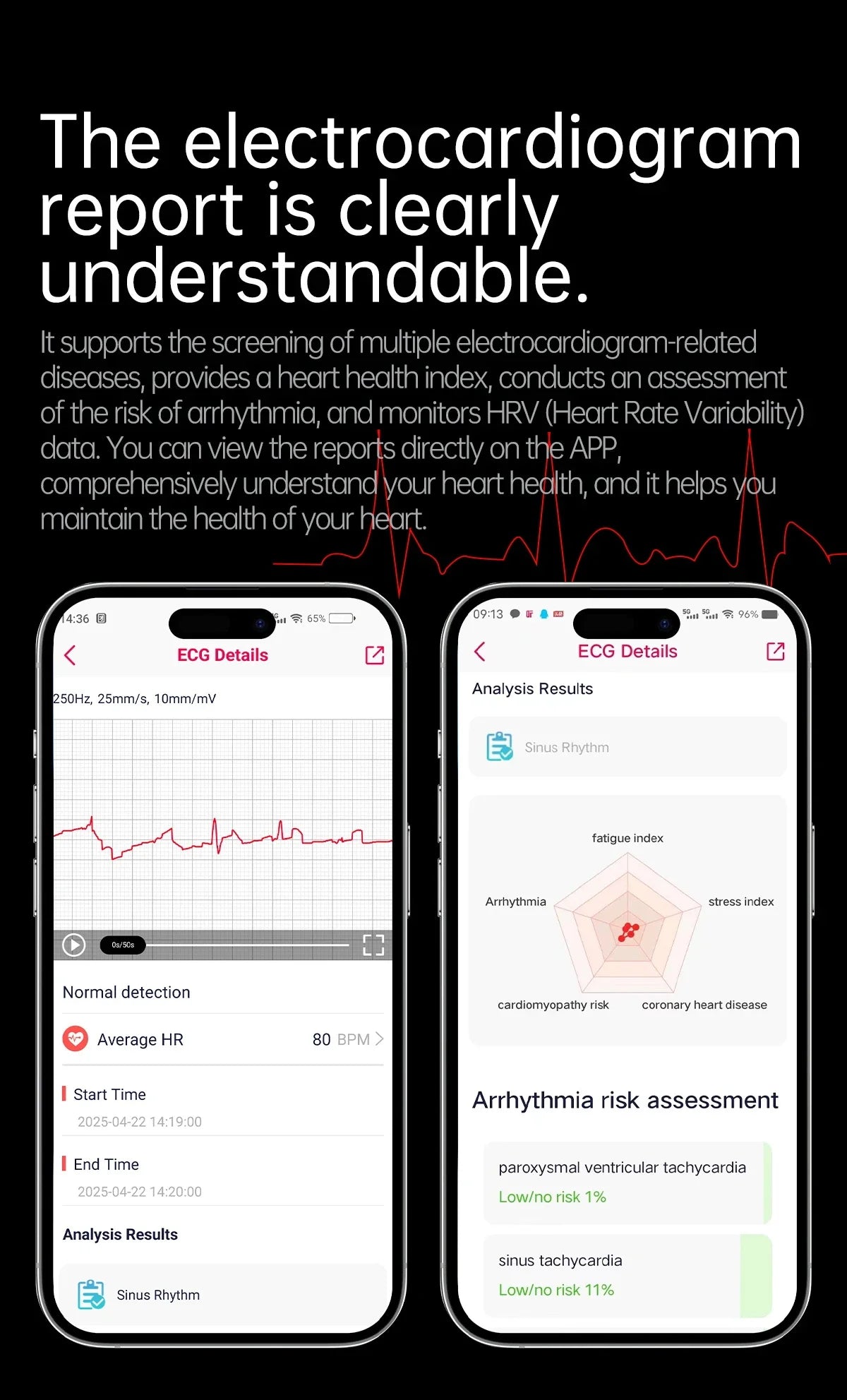 Reloj Inteligente Enfermería ECG+PPG Presión