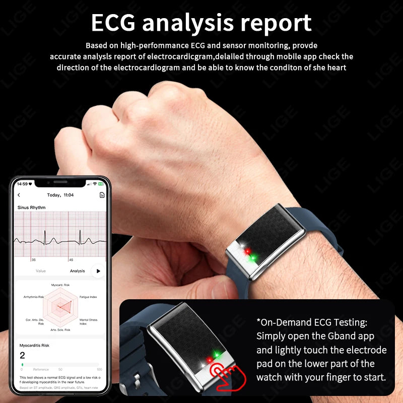 Pulsera inteligente ECG con monitor de salud, frecuencia cardíaca y ácido úrico, IP68