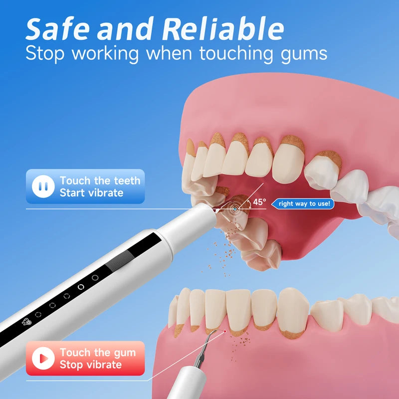 Escalador Dental eléctrico con vibración sónica, placa para blanquear los dientes, cálculo, café, humo, manchas, eliminación de sarro, cepillo de dientes