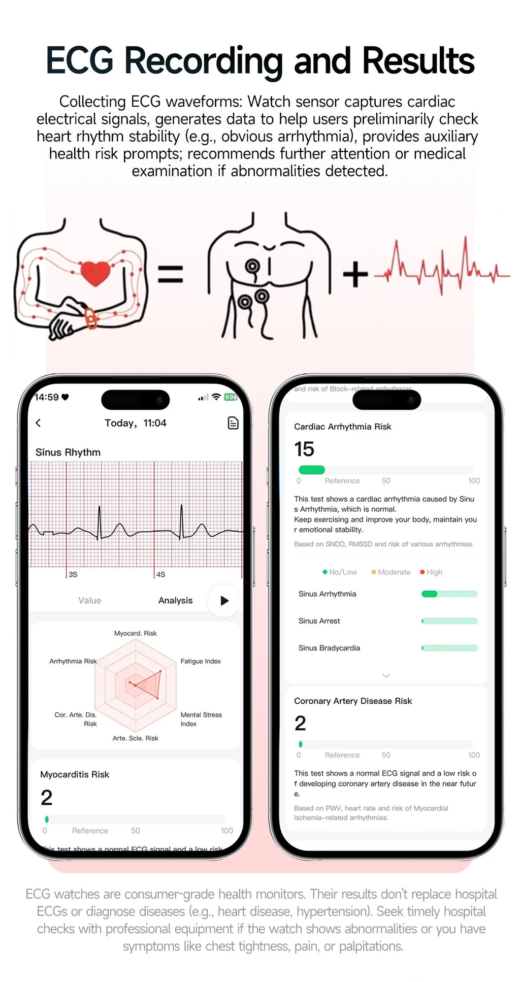 Reloj Inteligente con Diagnóstico ECG, Oxígeno en Sangre y Pantalla AMOLED