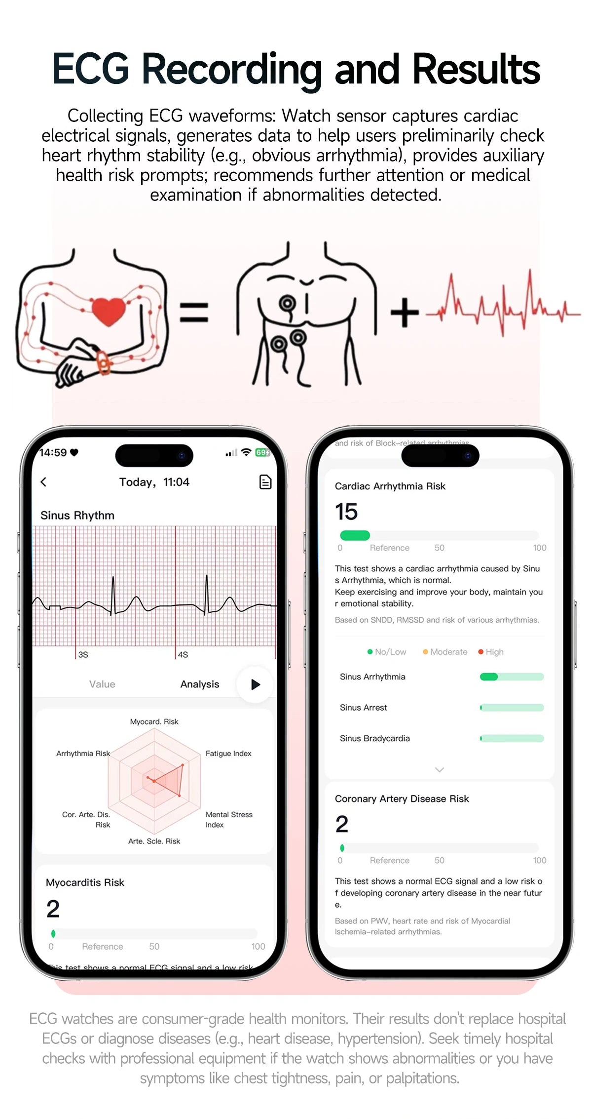 Reloj Inteligente con Diagnóstico ECG, Oxígeno en Sangre y Pantalla AMOLED
