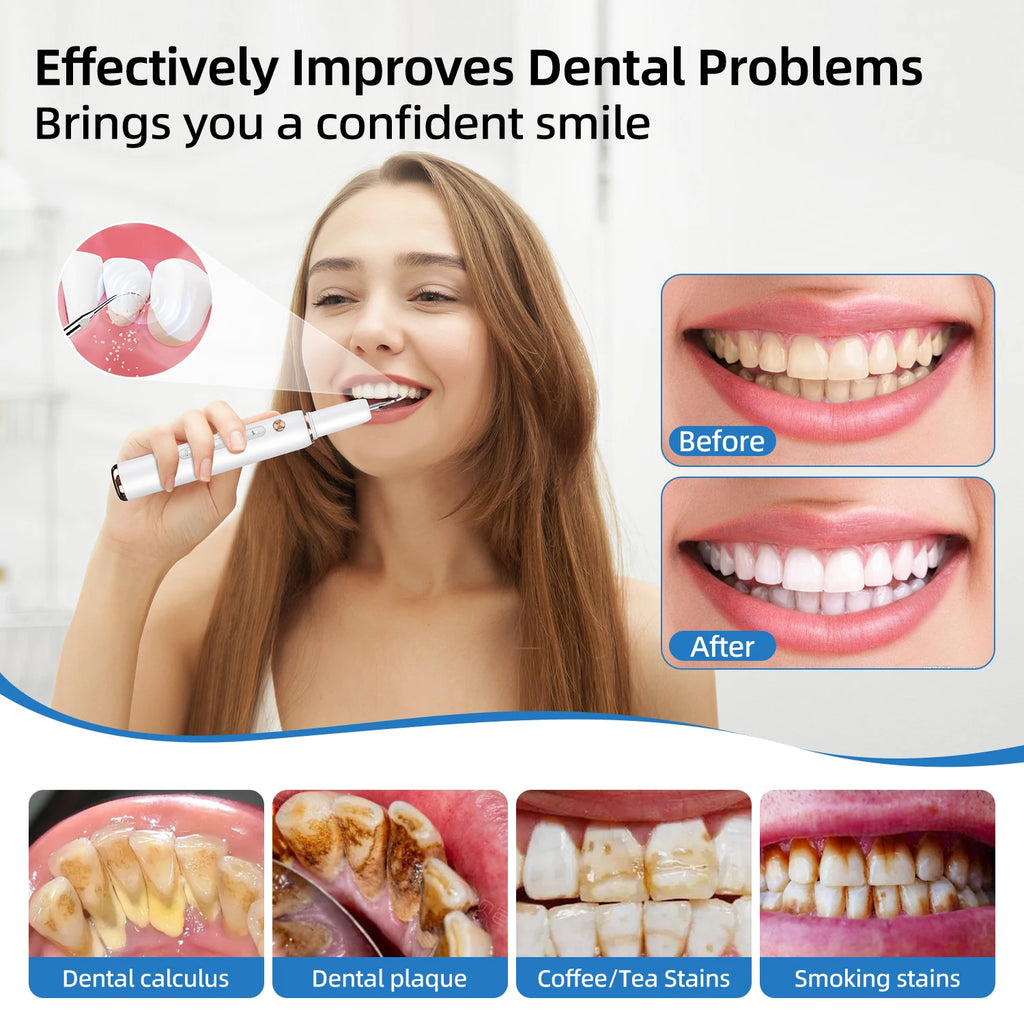 Escalador Dental ultrasónico para dientes, eliminador de cálculo Dental para manchas de sarro, limpiador de placa Dental sónico eléctrico, eliminación de piedra Dental