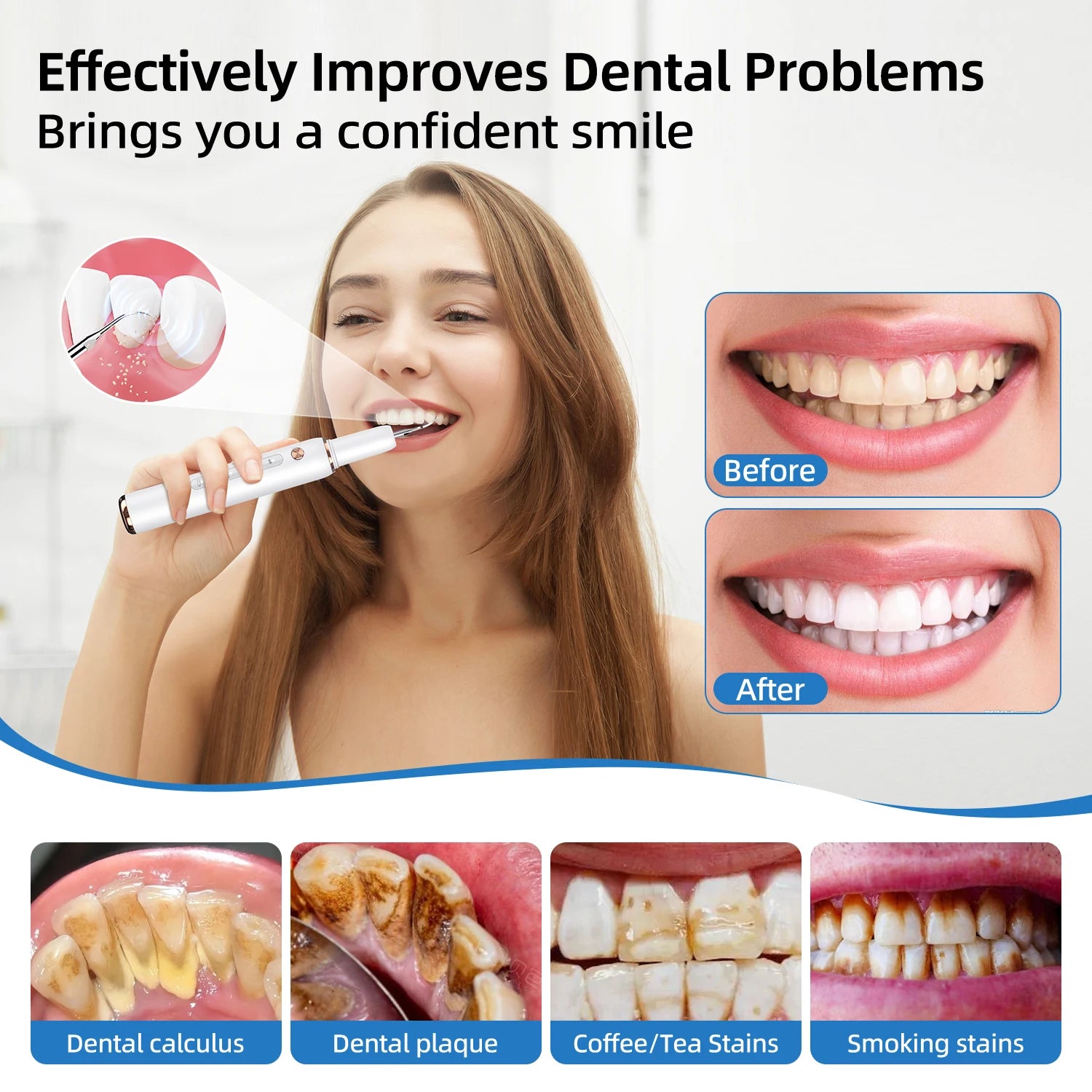 Escalador Dental ultrasónico para dientes, eliminador de cálculo Dental para manchas de sarro, limpiador de placa Dental sónico eléctrico, eliminación de piedra Dental