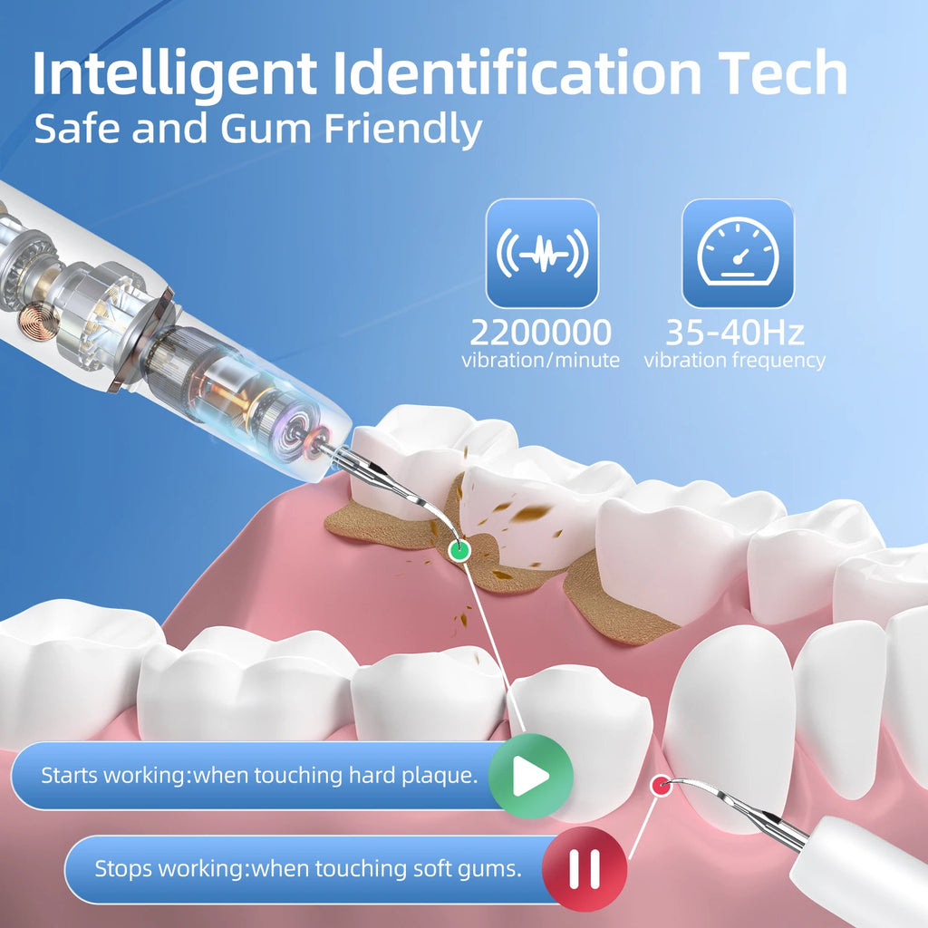 Escalador Dental ultrasónico para dientes, eliminador de cálculo Dental para manchas de sarro, limpiador de placa Dental sónico eléctrico, eliminación de piedra Dental