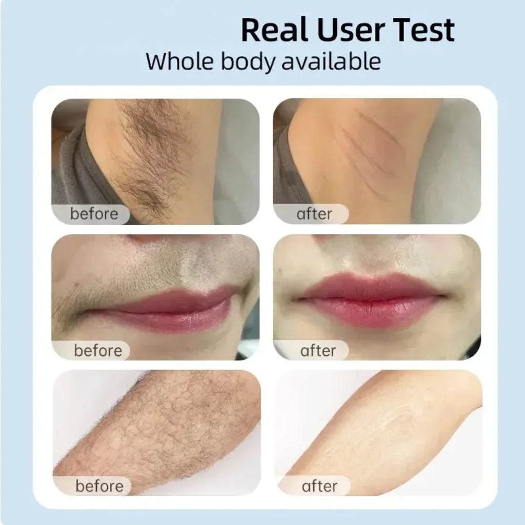 Dispositivo de depilación láser IPL, depiladora láser para mujeres, cuerpo, Bikini, Flashes ilimitados faciales, depiladora láser indolora permanente