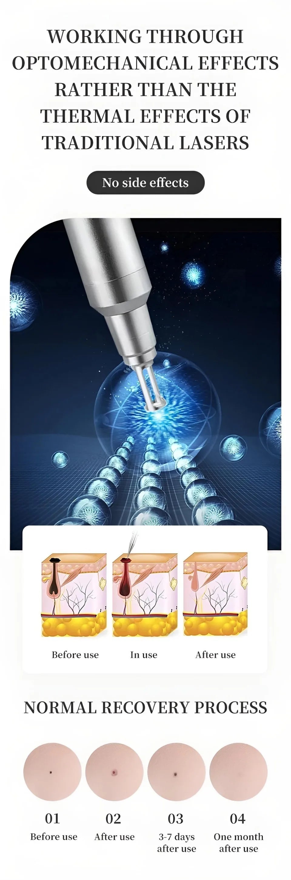 Máquina Láser Pico 532nm 1064nm para Eliminación de Tatuajes y Melasma, con Pantalla, Certificación CE/RoHS