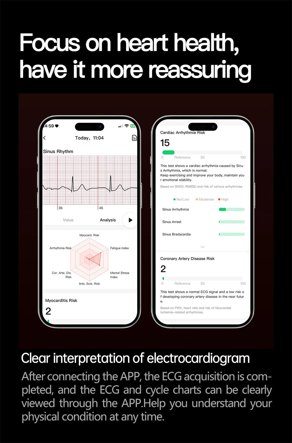 Nuevo Reloj Inteligente con Pantalla de Cristal de Zafiro de 1.73 Pulgadas, Monitor de Salud, Ácido Úrico, Grasa en Sangre, Presión Arterial, ECG+PPG, Análisis Corporal, para Hombre