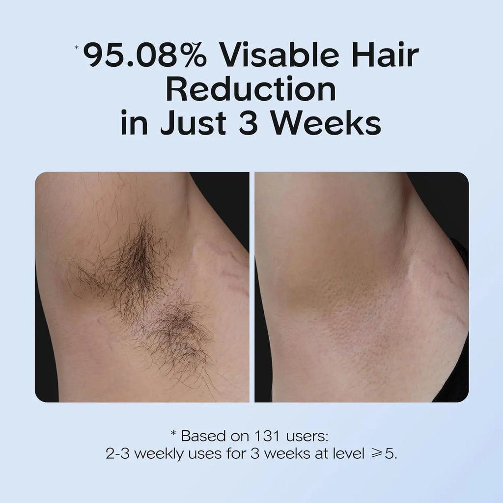 Dispositivo de depilación IPL 999.999 Flashes Depilación indolora con función de cuidado de enfriamiento por hielo Depilación con resultados duraderos