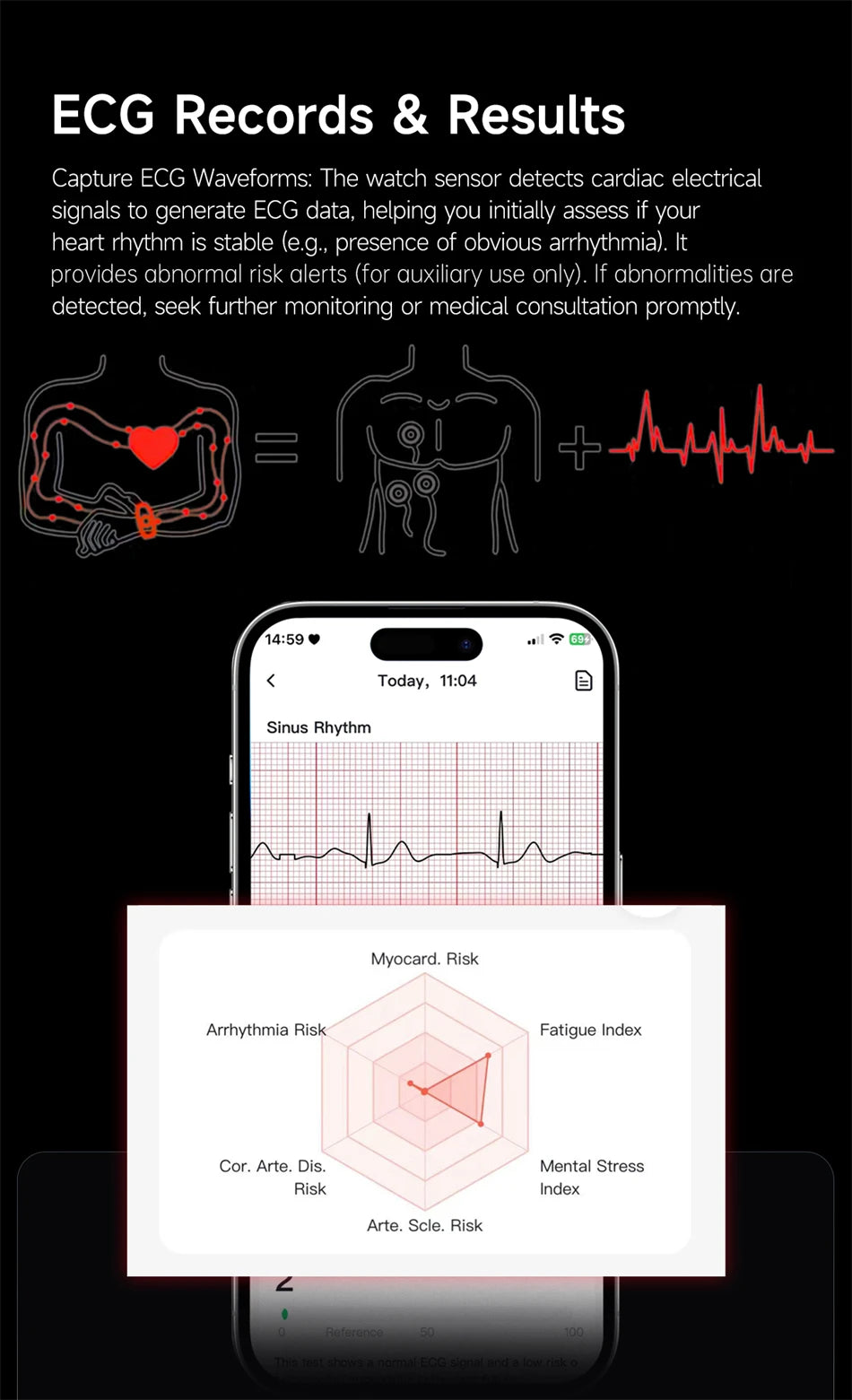 Reloj Inteligente LIGE Sin Pantalla con ECG y HRV