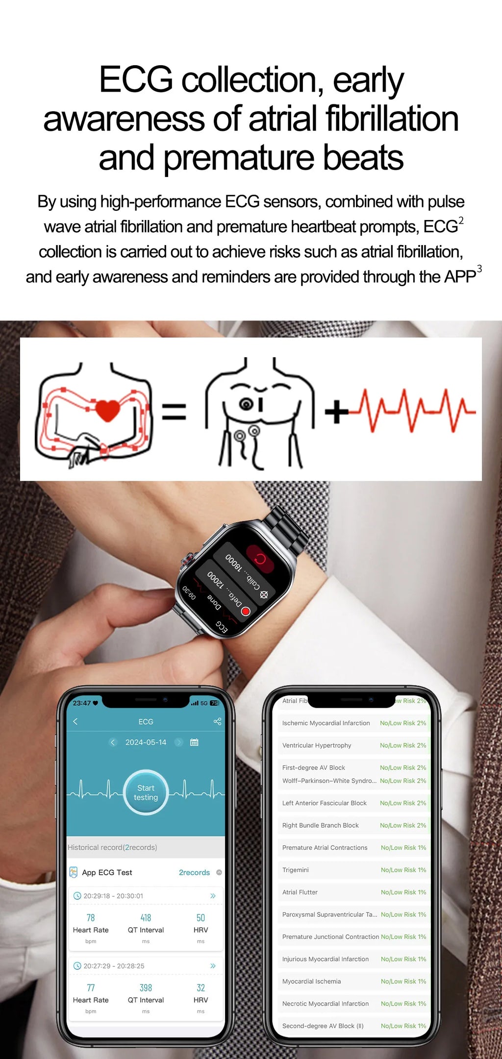 LIGE ET585 Reloj Inteligente AMOLED ECG