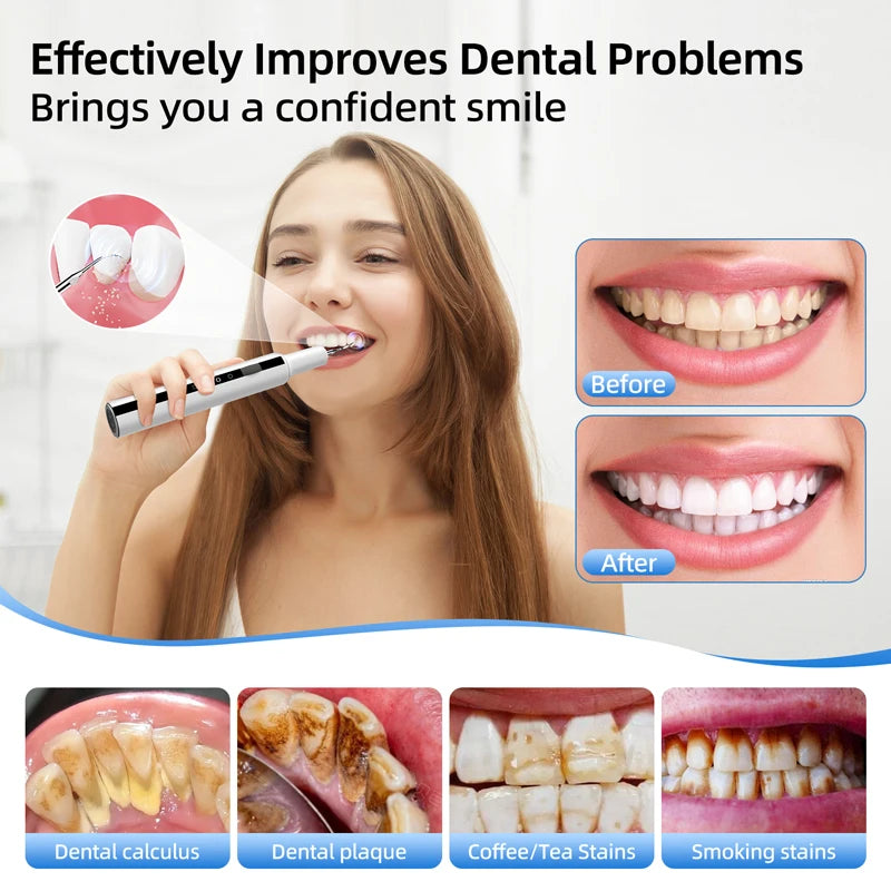 Escalador Dental eléctrico con vibración sónica, placa para blanquear los dientes, cálculo, café, humo, manchas, eliminación de sarro, cepillo de dientes