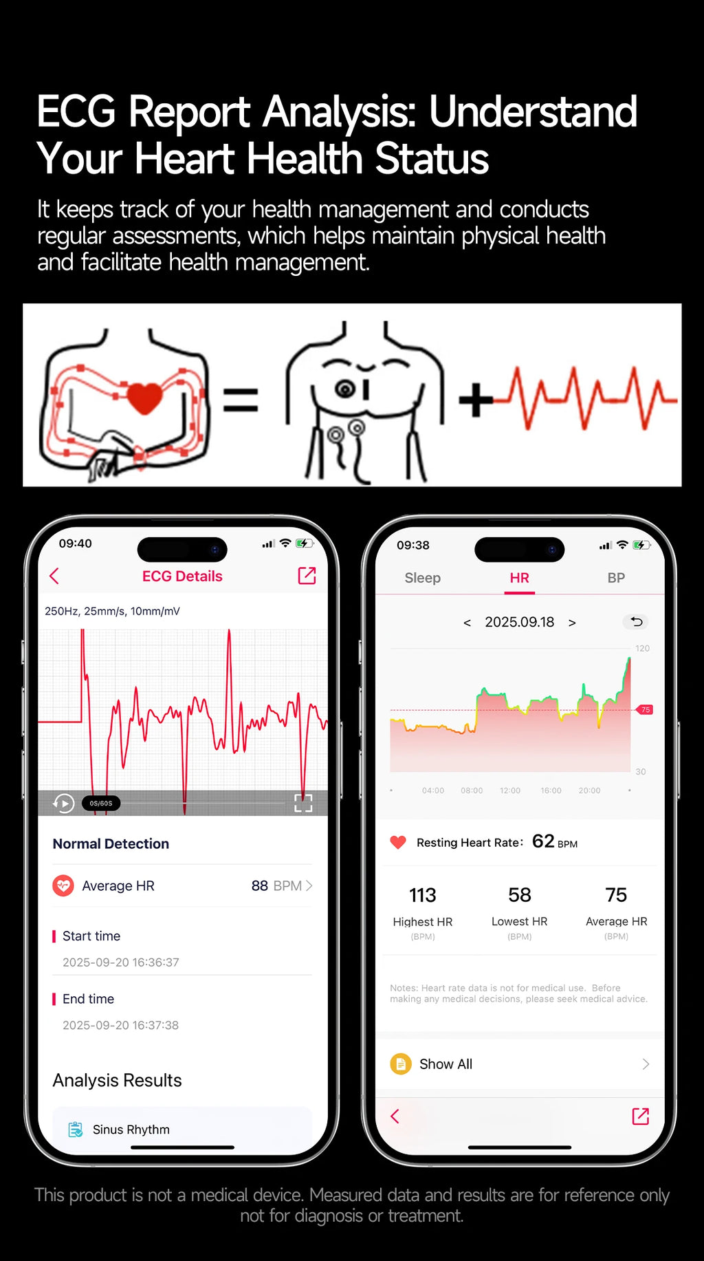 Reloj Inteligente con ECG, Grasa Corporal y Presión Arterial AMOLED