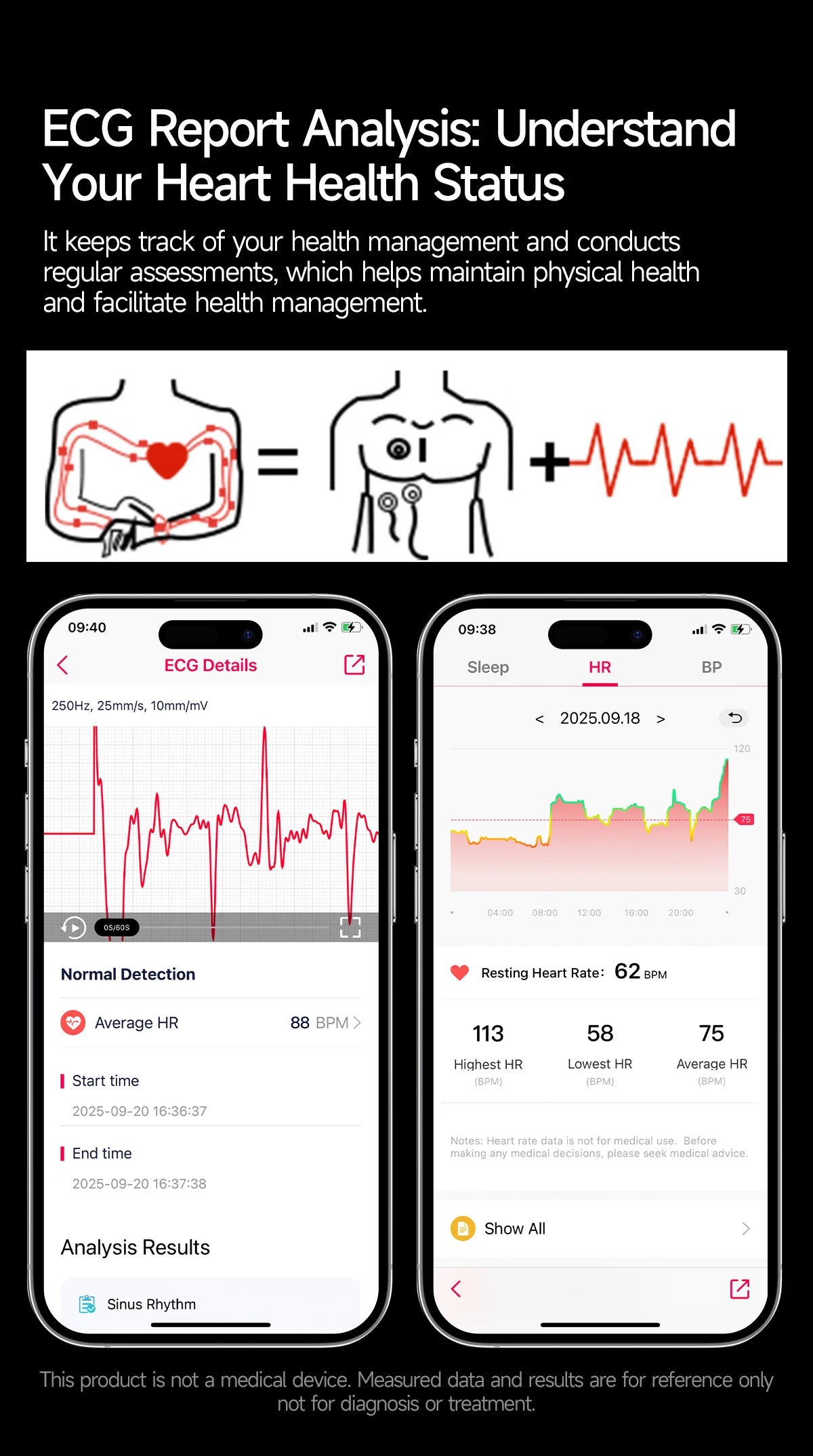 Reloj Inteligente con ECG, Grasa Corporal y Presión Arterial AMOLED