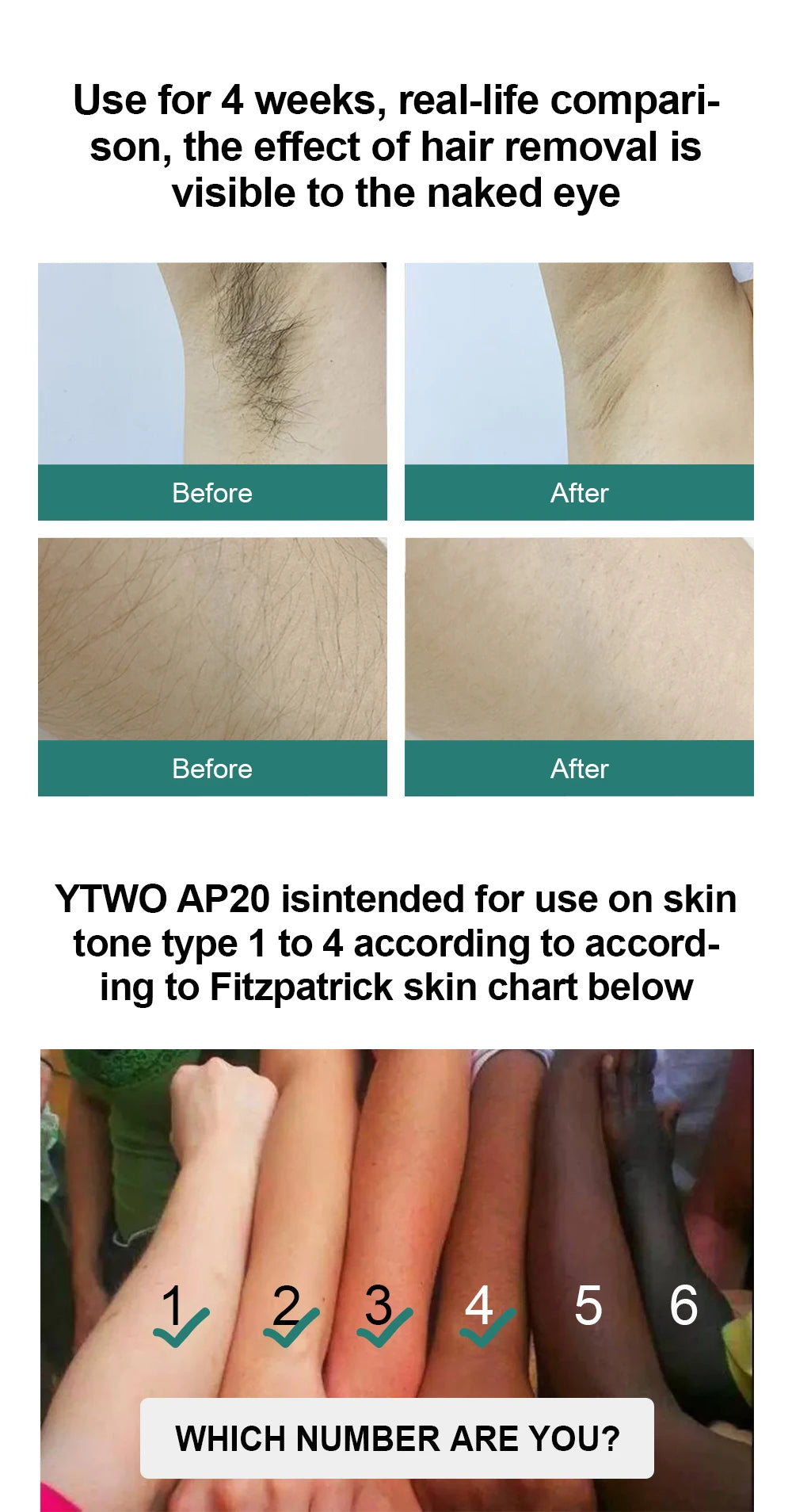Dispositivo de depilación láser IPL, depiladora láser para mujeres, cuerpo, Bikini, Flashes ilimitados faciales, depiladora láser indolora permanente