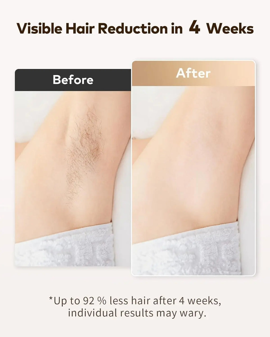 Dispositivo de depilación láser IPL 3 en 1, 999900 Flashes, depiladora permanente de 9 niveles, tratamiento para todo el cuerpo, uso doméstico para hombres y mujeres