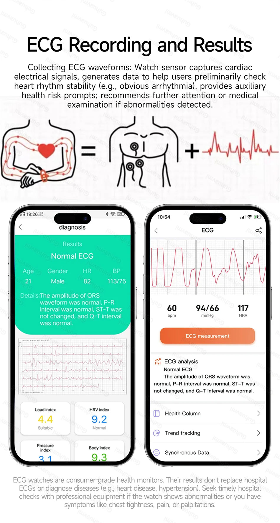 Reloj Inteligente Salud Dual Láser ECG