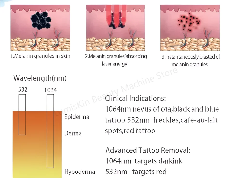 Máquina Láser Pico 532nm 1064nm para Eliminación de Tatuajes y Melasma, con Pantalla, Certificación CE/RoHS