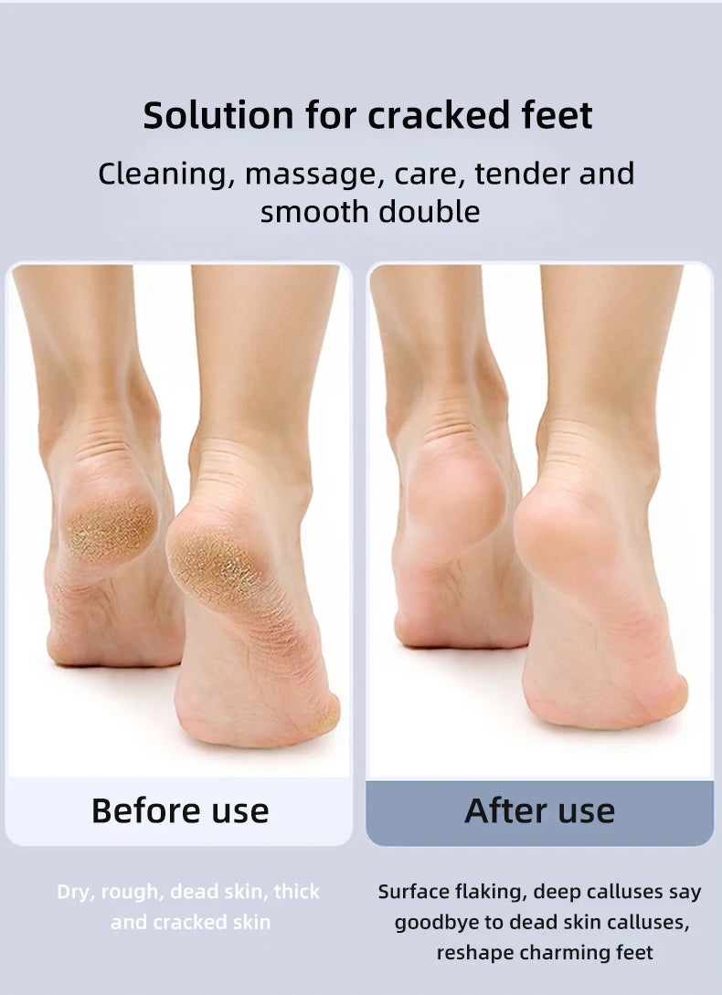    Removedor de callos de pies eléctrico plegable, exfoliación de pies, 9 velocidades ajustables, depurador de pies para pedicura de piel muerta agrietada